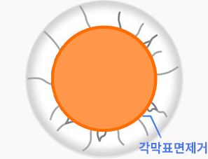 각막신경손상도1.png