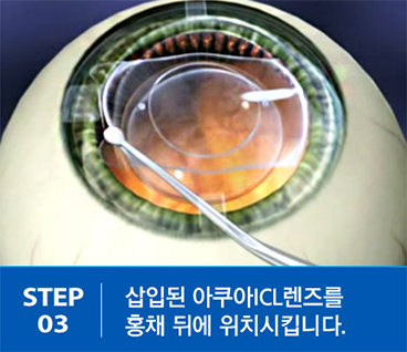 step03.png