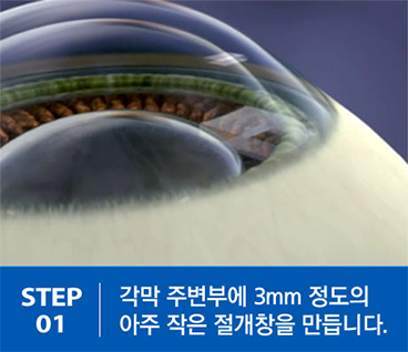 step01.png